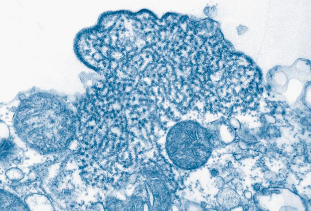 Nipah henipavirus