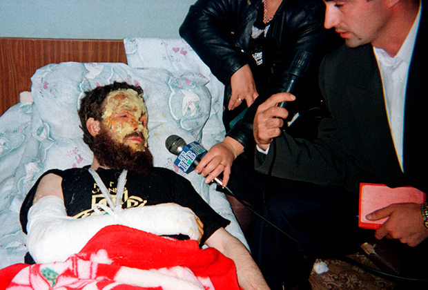 Журналисты общаются с Салманом Радуевым в больнице после покушения. Февраль 1997 года