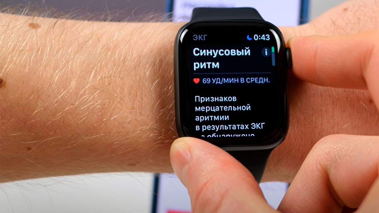 Apple запустила ЭКГ на часах в России: Гаджеты: Наука и техника: Lenta.ru