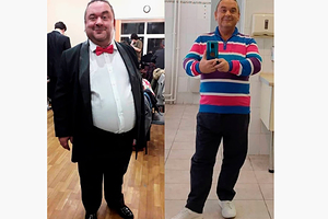 Артист «Кривого зеркала» сделал операцию ради похудения Александр Морозов рассказал о новом хирургическом вмешательстве для потери лишнего веса