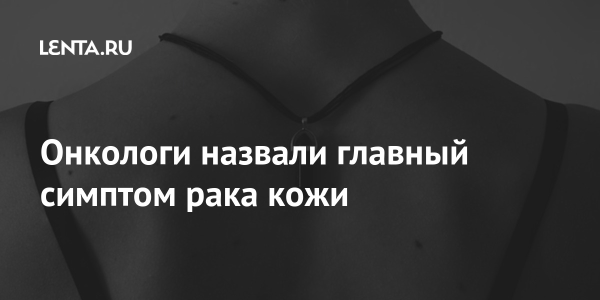 Онкологи назвали главный симптом рака кожи: Здоровье: Наука и техника ...