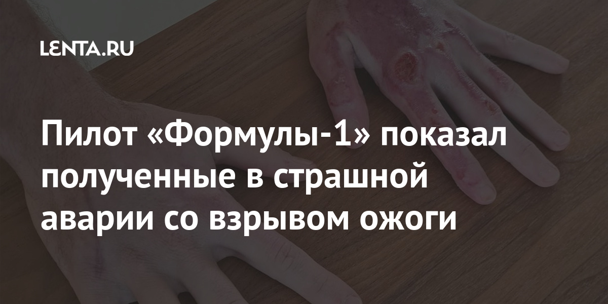 Как получить льготные лекарства. Ученик отличник. Порядок оформления заказа. Этапы оформления заказа. Как получить снилс.
