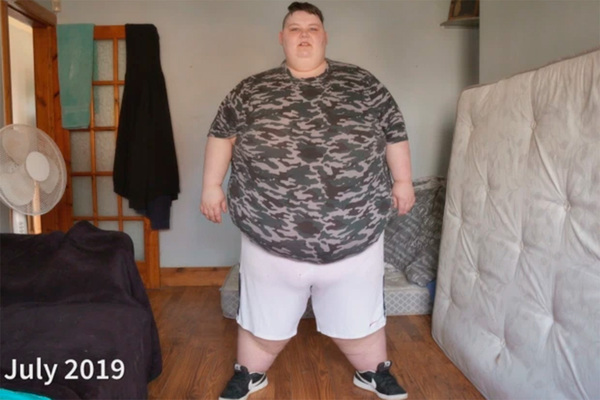 Morbidly obese AJ