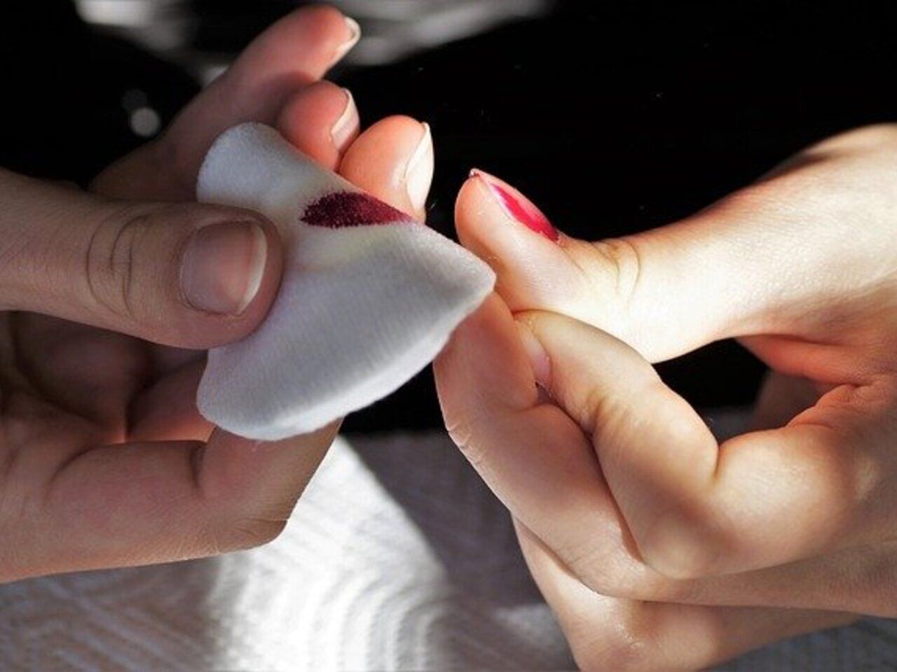 Черное пятно под ногтем: причины и лечение