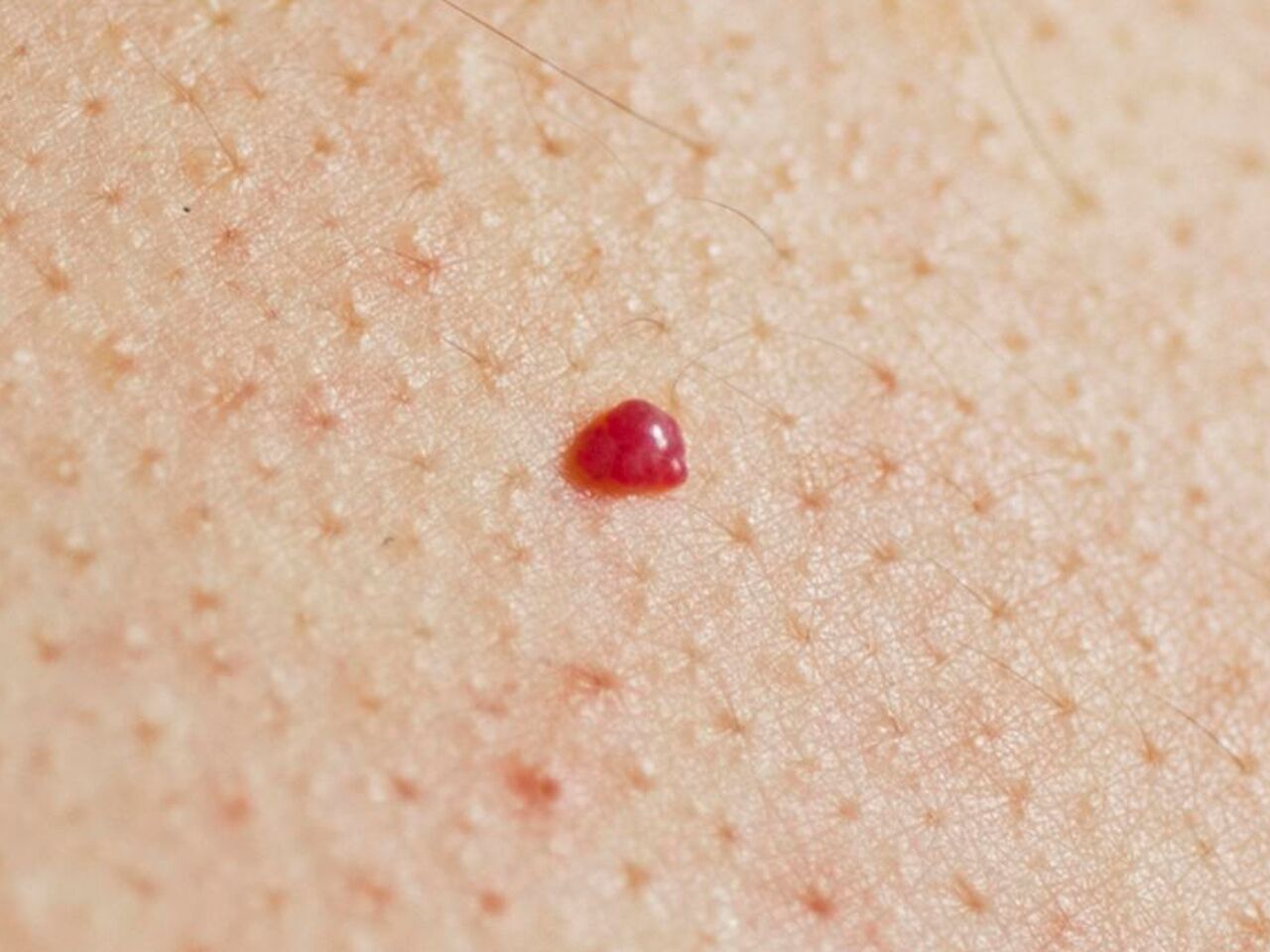 Красные пятна на коже: причины и лечение