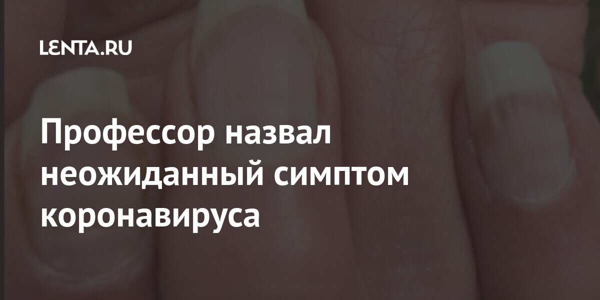 Профессор назвал неожиданный симптом коронавируса share e1e94dacc43a332fcddddb7632afa902 - Профессор назвал неожиданный симптом коронавируса