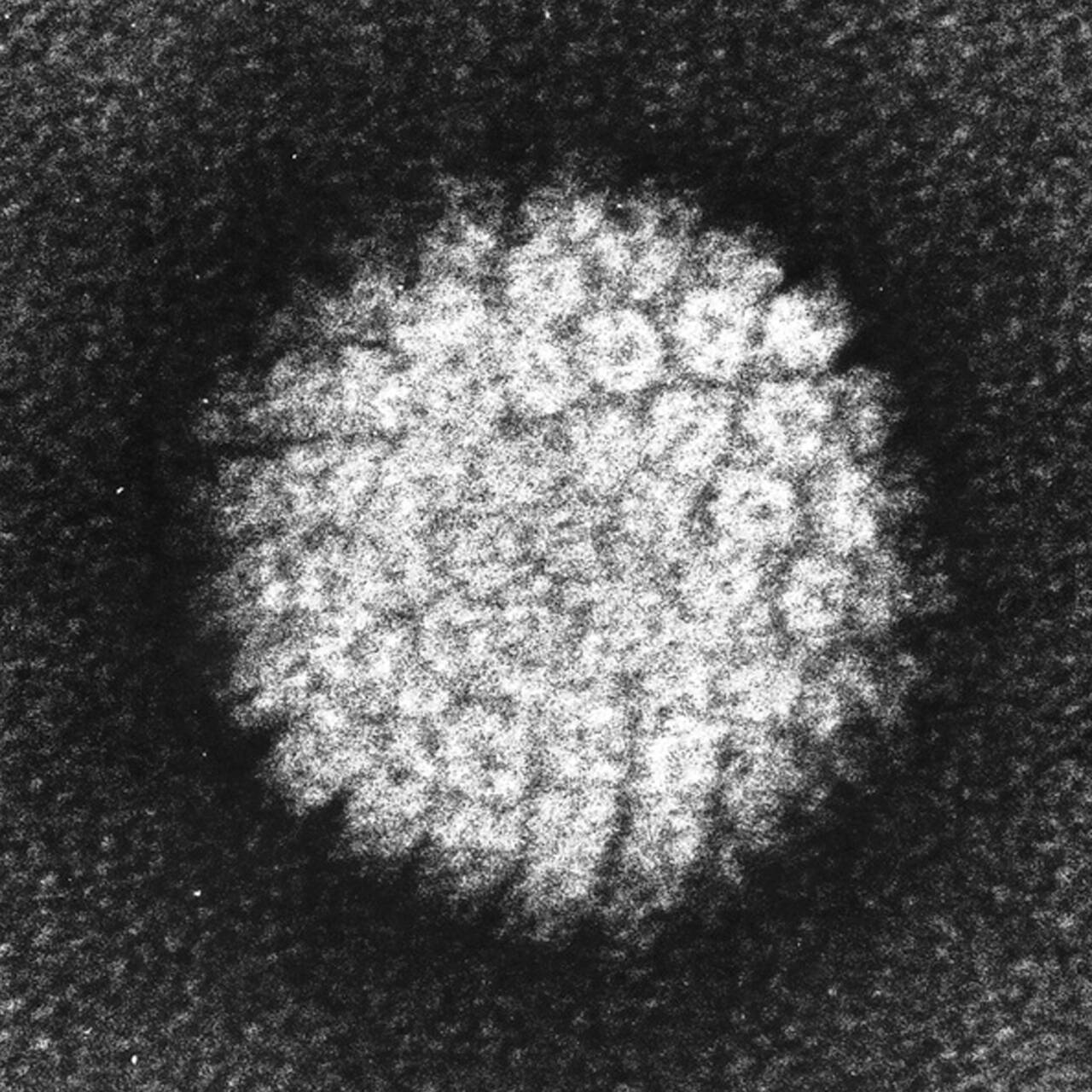 Вирус ВПЧ под микроскопом