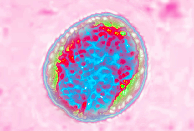 Бактерия Brucella, вызывающая бруцеллез или мальтийскую лихорадку
