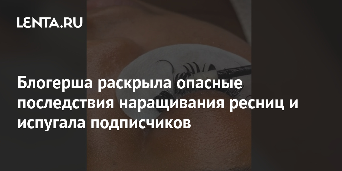 Блогерша раскрыла опасные последствия наращивания ресниц и испугала ...