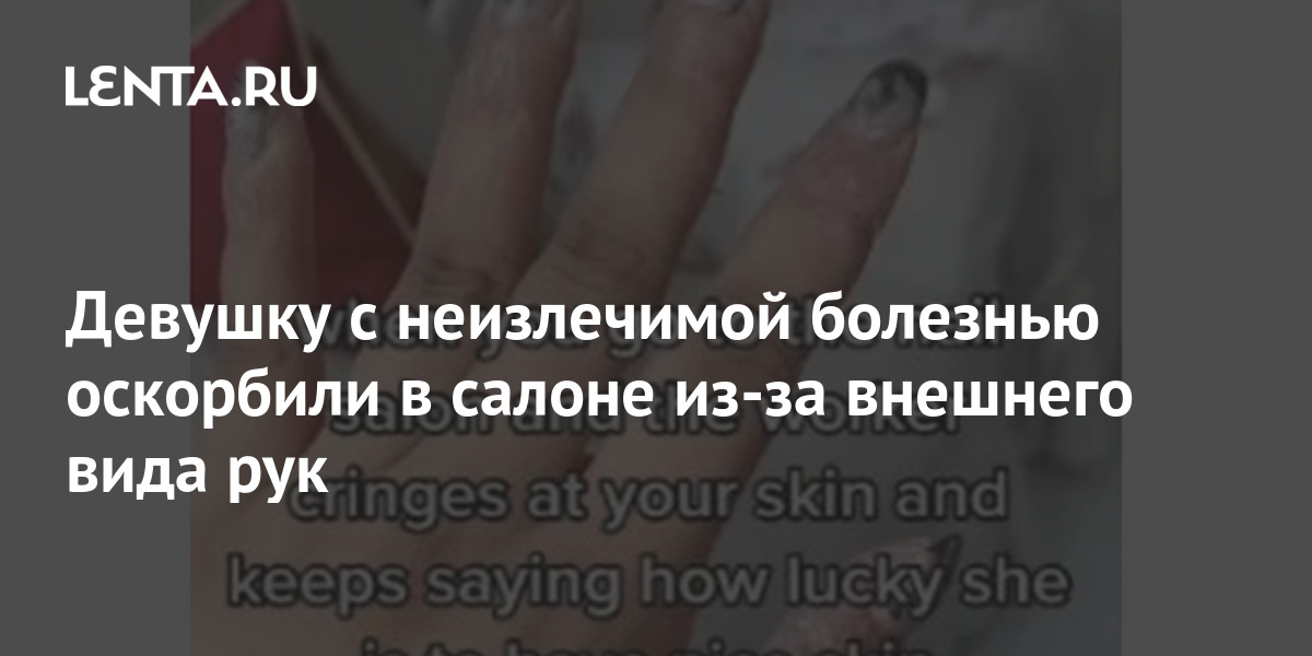 Девушку с неизлечимой болезнью оскорбили в салоне из-за внешнего вида