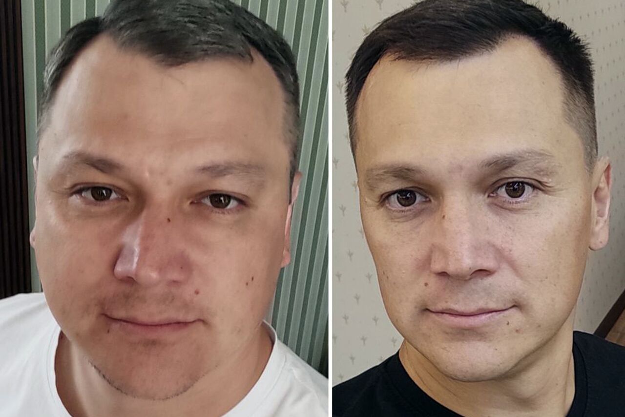 Как меняется внешность после отказа от курения у мужчин фото
