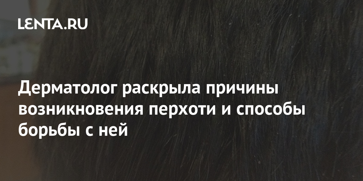 Дерматолог раскрыла причины возникновения перхоти и способы борьбы с ...