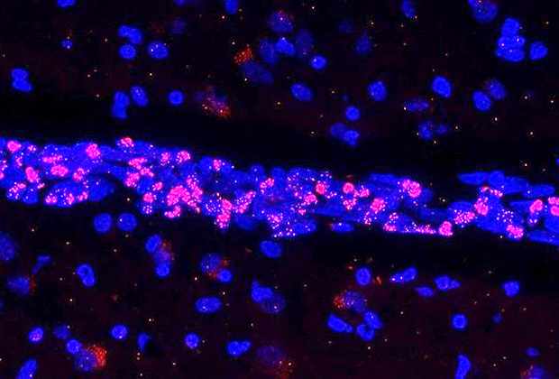 Экспрессия генетического материала SARS-CoV-2 (показан красным) в эндотелиальных клетках