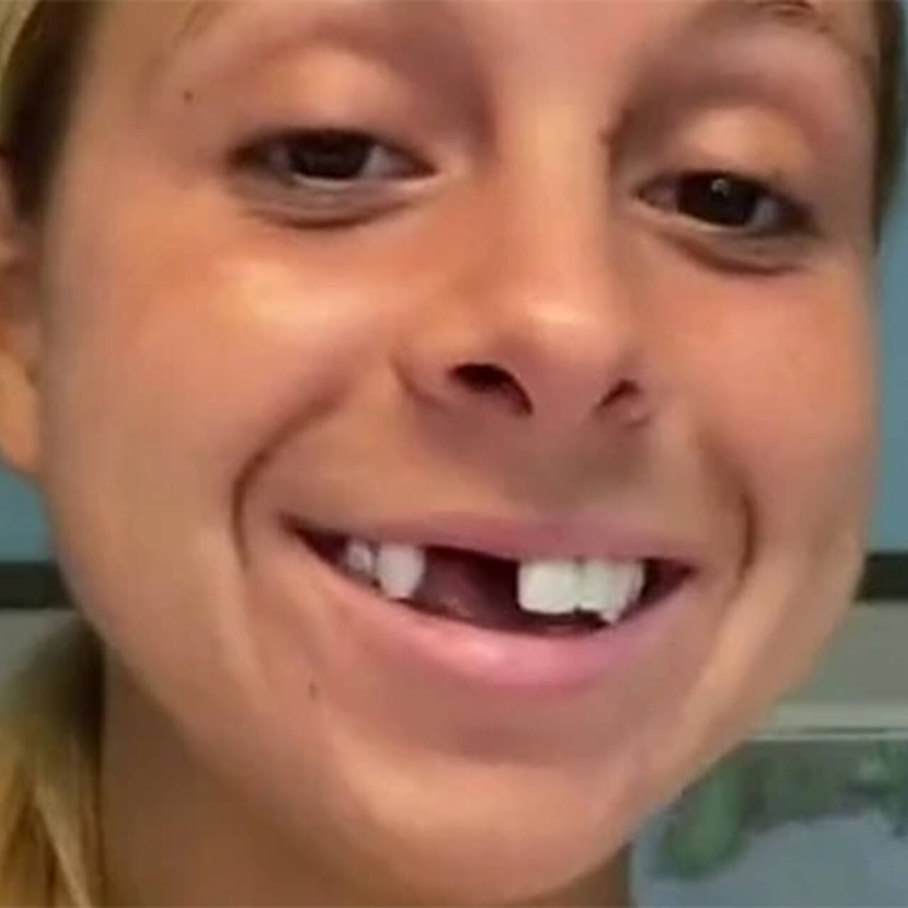 девушка без переднего зуба фото