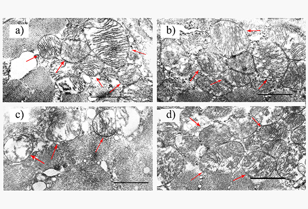 View of mitochondria in normal mice (a), in normal mice with an injection of a drug (b), in mice with diabetes (c), in mice with diabetes and an injection of a drug (d)