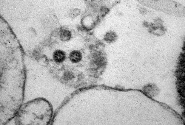Изображение омикрон-варианта коронавируса