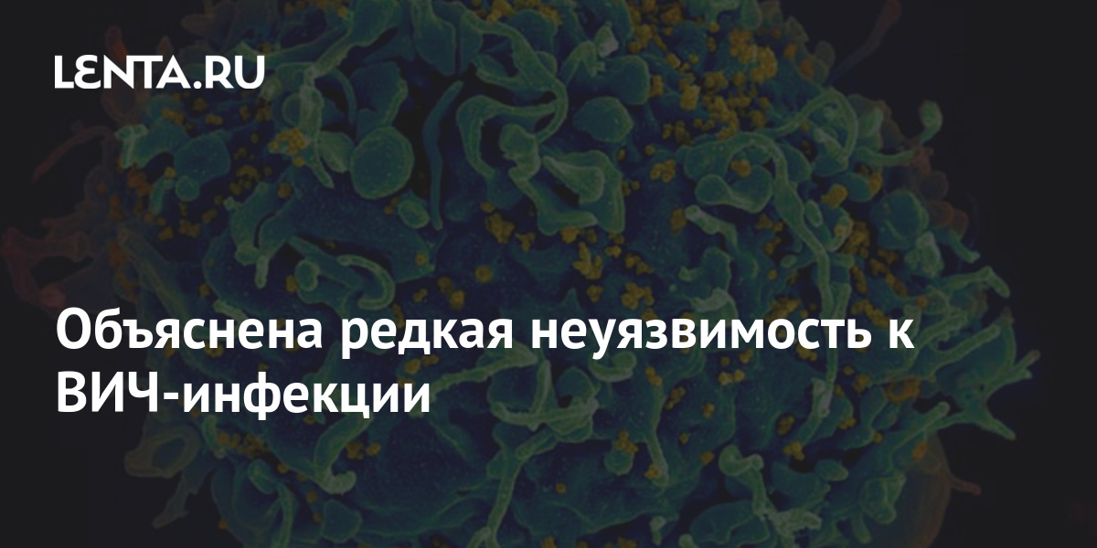 Объяснена редкая неуязвимость к ВИЧинфекции Здоровье