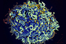 This electron microscope image made available by the U.S. National Institutes of Health shows a human T cell, in blue, under attack by HIV, in yellow, the virus that causes AIDS. The virus specifically targets T cells, which play a critical role in the body's immune response against invaders like bacteria and viruses. Colors were added by the source. On Thursday, March 7, 2019, researchers reported that monthly shots of HIV drugs worked as well as daily pills to control the virus that causes AIDS in two large international tests.