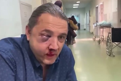 Избитому в Москве бывшему депутату Госдумы назначили операцию