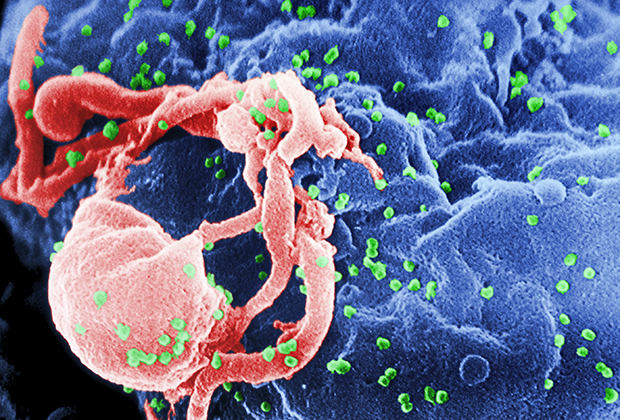 Зараженный ВИЧ Т-лимфоцит. Фото: C. Goldsmith / Centers for Disease Control and Prevention