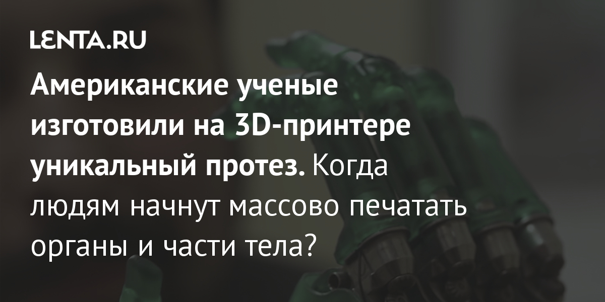 3D-печать индивидуальных протезов