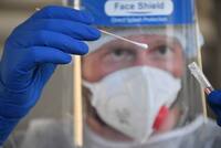 В России зарегистрировали первый в мире изотермический тест на коронавирус 