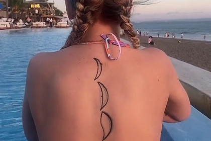 Блогерша сделала татуировку хной и осталась с ожогами второй степени
