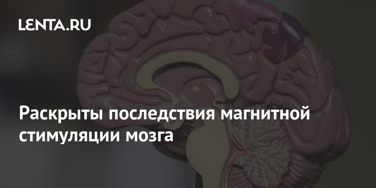 Раскрыты последствия магнитной стимуляции мозга: Наука: Наука и техника ...