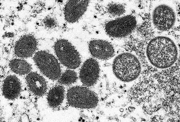 Микроскопическое изображение вирусов обезьяньей оспы
