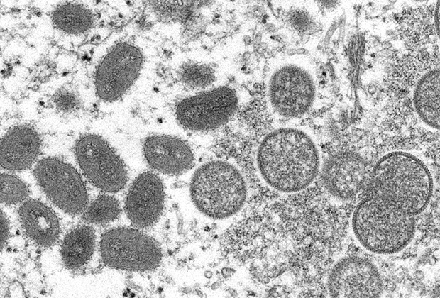 Клетки вируса обезьяньей оспы (слева)