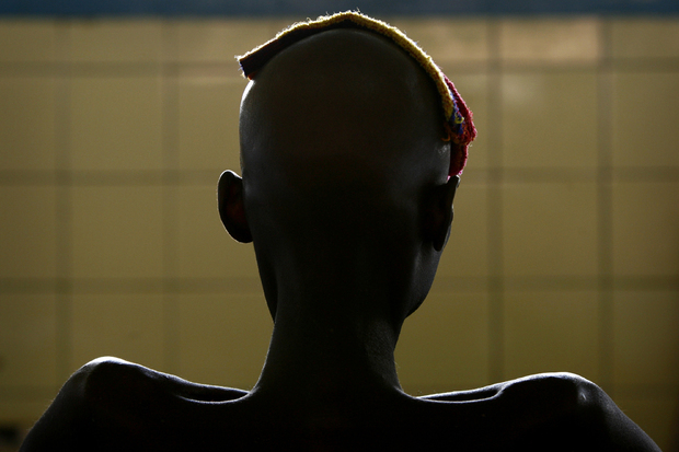 Пациент с ВИЧ в Конго. Фото: Finbarr O'Reilly / Reuters