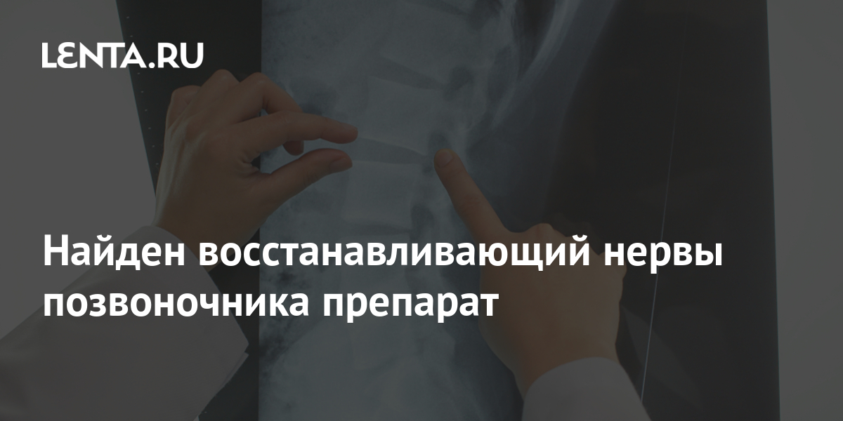 Препарат для позвоночника и суставов. БАЖ Артросан для суставов и позвоночника: продажа, цена в Киеве. Препарат для суставов и связок GCM JOINT, 60 капсул, Ёбатон - купить с. Купить Транкал Trankal препарат для позвоночника и суставов, 100 капсул.