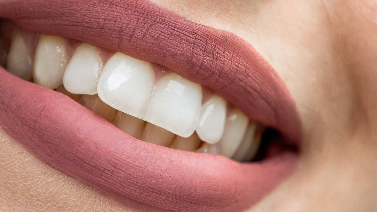 Появление разводов и пятен на зубах