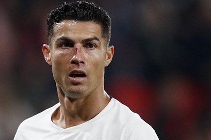 Роналду разбили лицо в матче Лиги наций