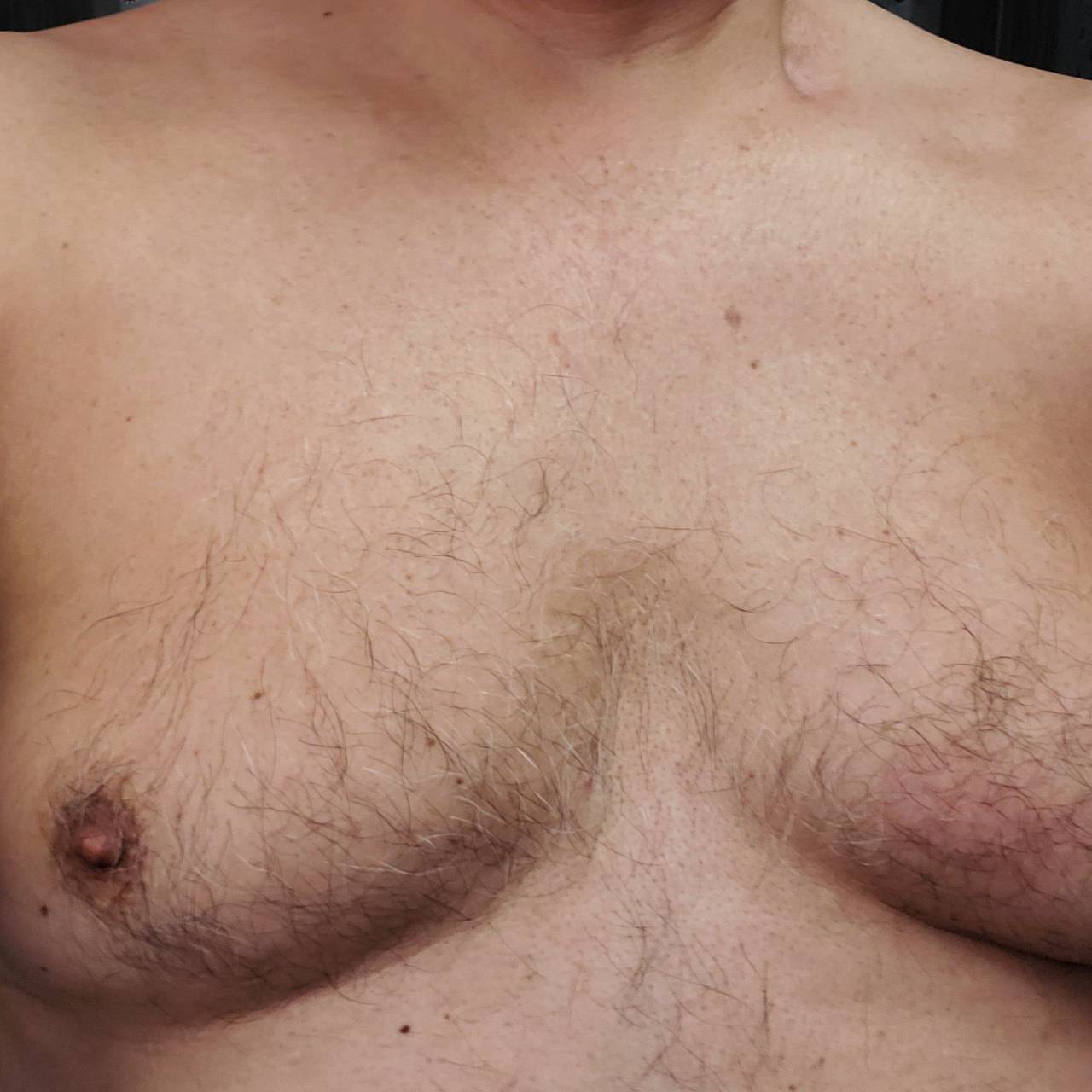 Онколог предупредил о факторах развития доброкачественной опухоли груди у мужчин: Уход за собой: Забота о себе: Lenta.ru