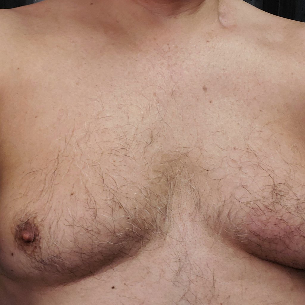грудь у мужчин признаки фото 30