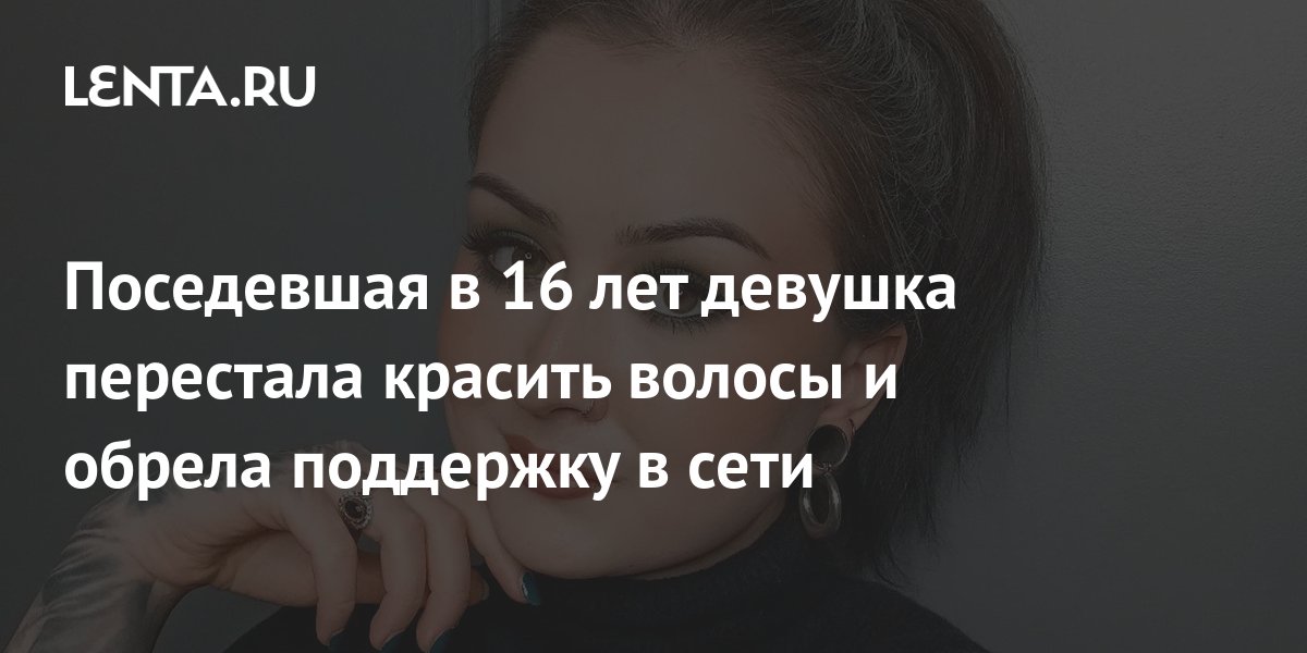 от чего могут появляться седые волосы в 17 лет