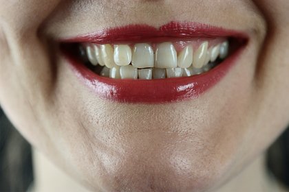 Названы способы сохранить здоровье зубов в экстремальных условиях