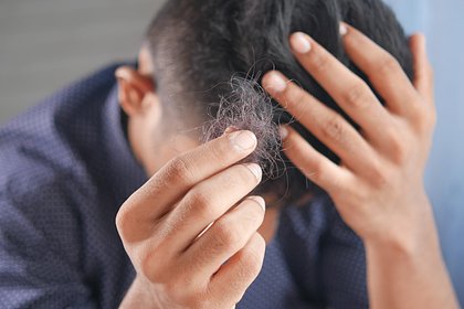 Россиянам раскрыли главные причины выпадения волос зимой