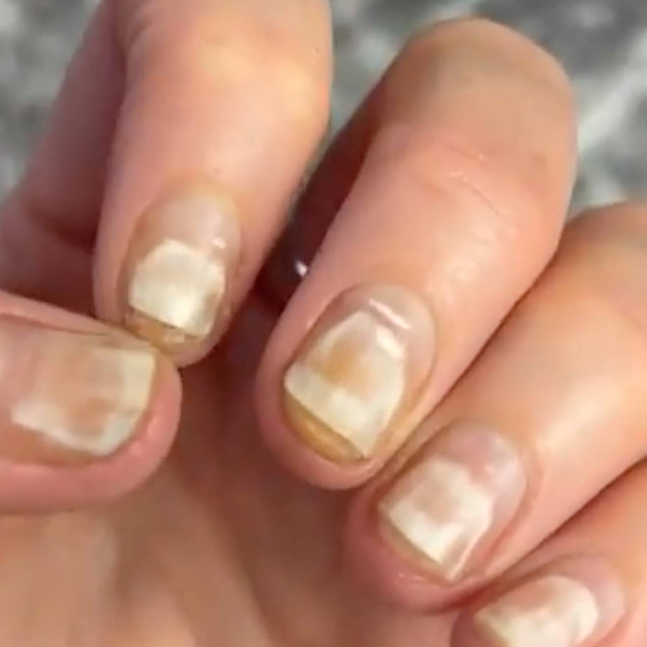 Как восстановить ногти после гель-лака?