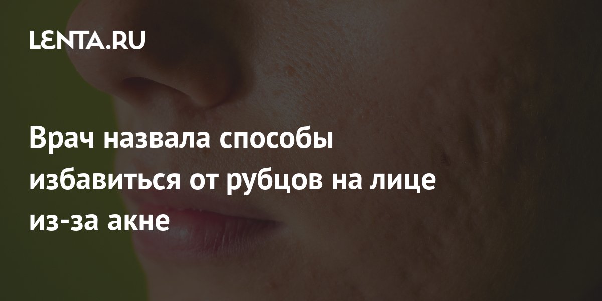 Врач назвала способы избавиться от рубцов на лице из-за акне: Уход за ...