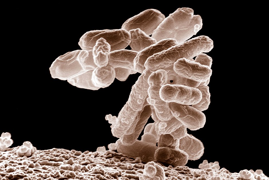 Большинство штаммов E. coli являются безвредными, однако определенные серотипы могут вызывать тяжелые пищевые отравления у людей и животных