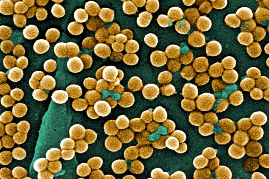 Колонии бактерии способны возбуждать гнойно-воспалительные процессы в организме человека.