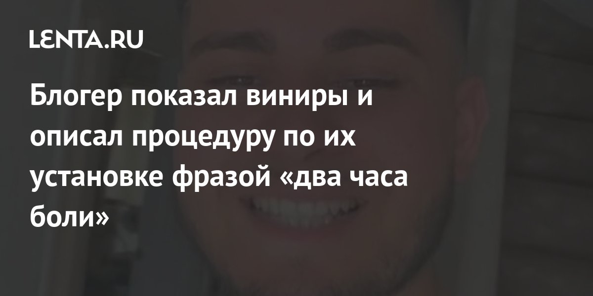 Блогер показал виниры и описал процедуру по их установке фразой «два ...