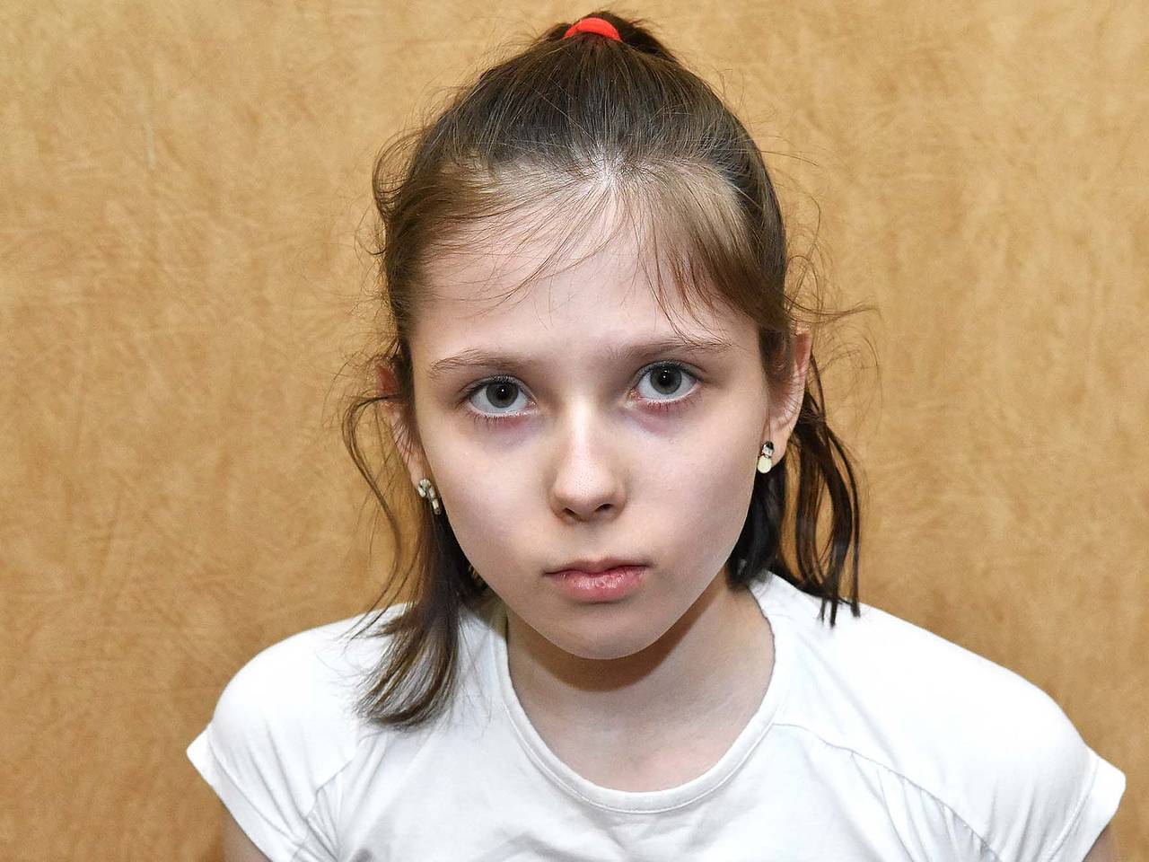 двенадцатилетние Какое это счастье — не чувствовать боль» Двенадцатилетнюю девочку спасет  операция на позвоночнике. Ей нужна ваша помощь: Общество: Россия: Lenta.ru