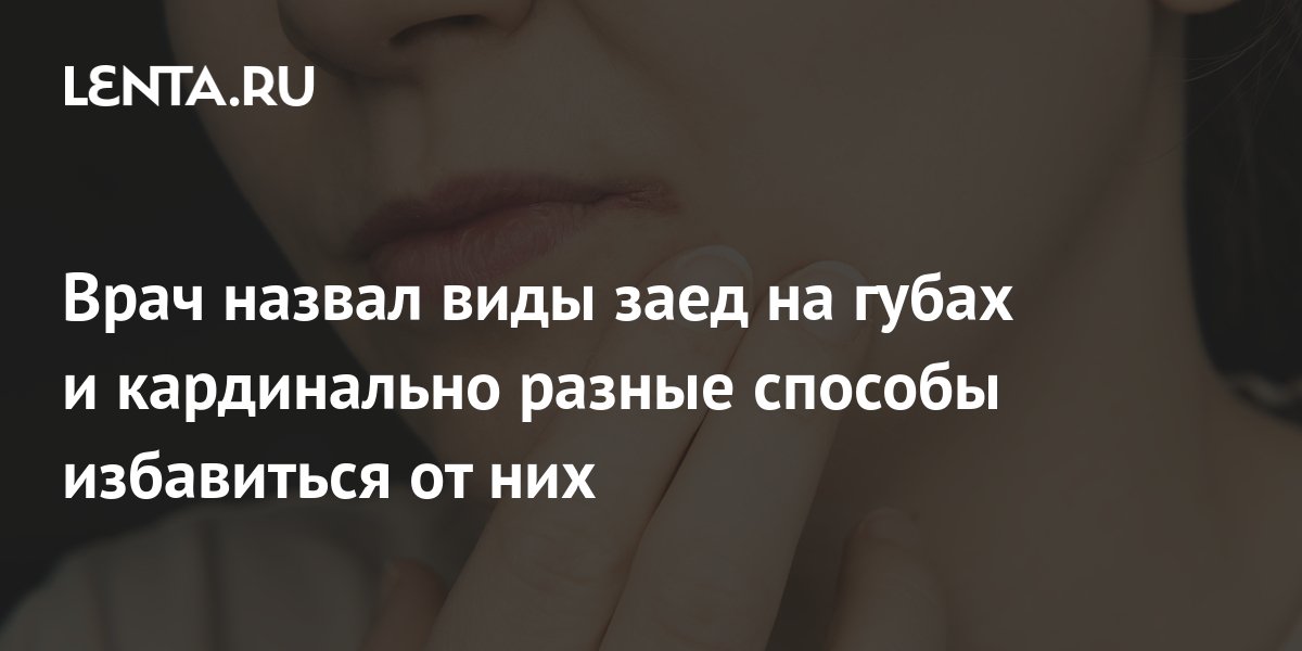 Врач назвал виды заед на губах и кардинально разные способы избавиться ...