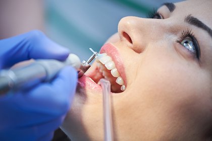 Стоматолог развеяла мифы о здоровье зубов