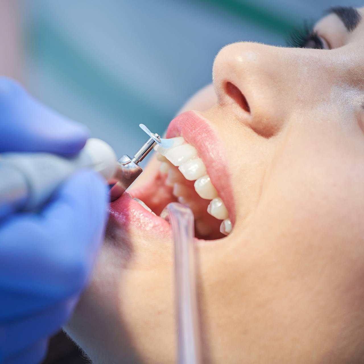 Кислые продукты