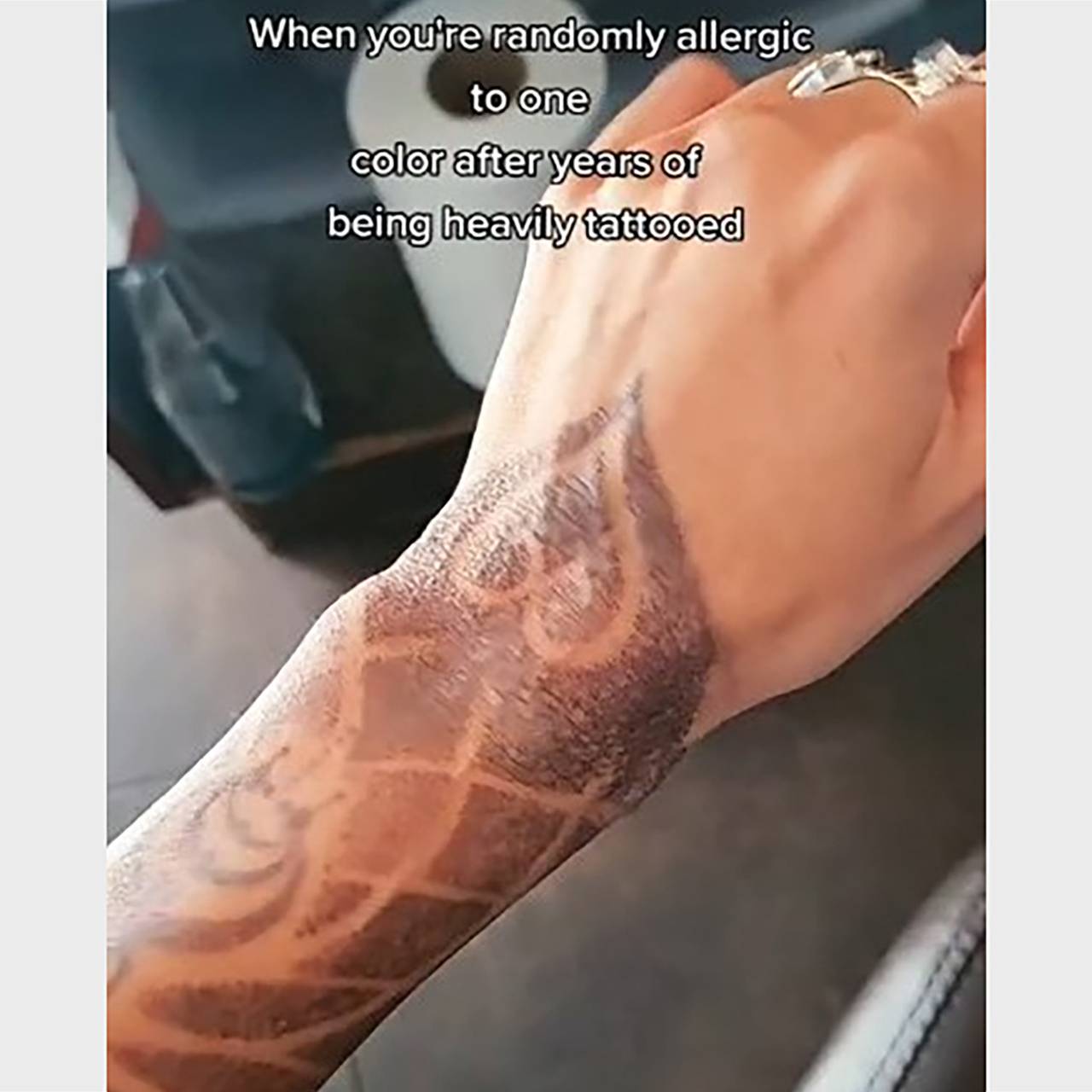 Проявления аллергии на пигменты татуажа