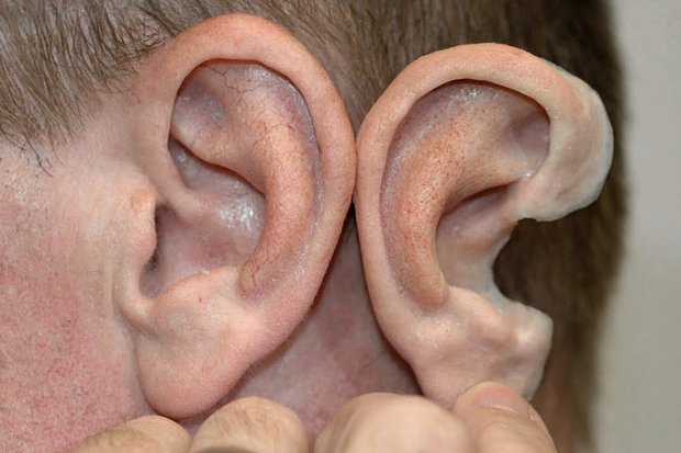 Напечатанное на биопринтере ухо. Фото: 3DBio Therapeutics